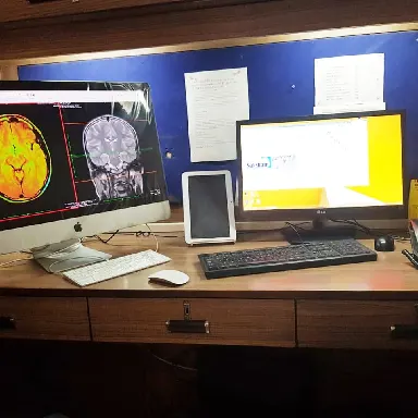 ultra-sound-color-doppler